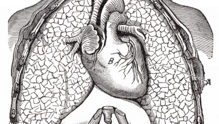 vintage heart and lungs pa doctor